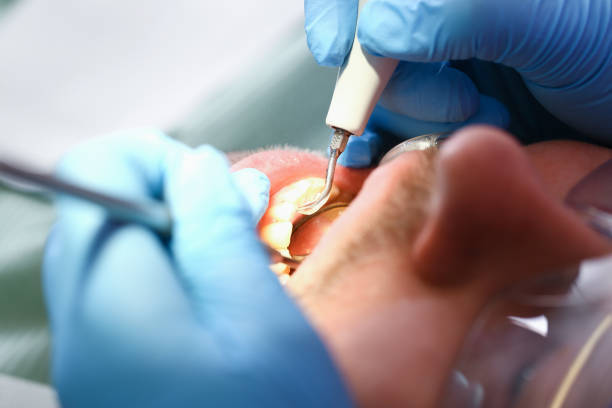 Best Broken or Chipped Tooth Repair in Mccord, OK