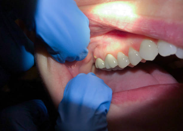 Best 24-Hour Emergency Dental Care in Mccord, OK